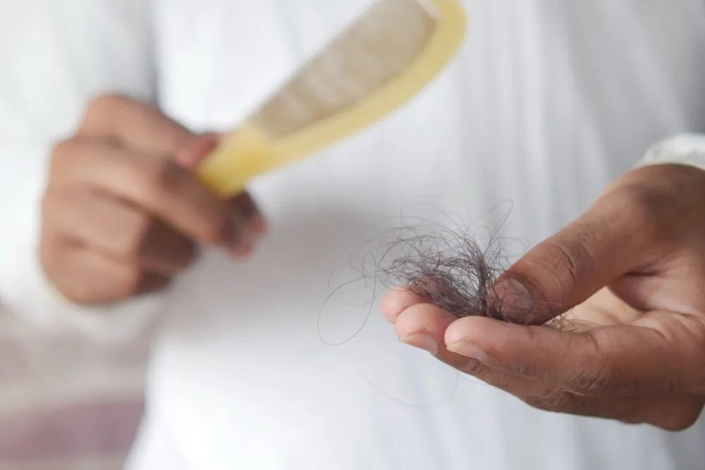 Alopecia Androgenética: Causas, Diagnóstico y Tratamientos en 2024