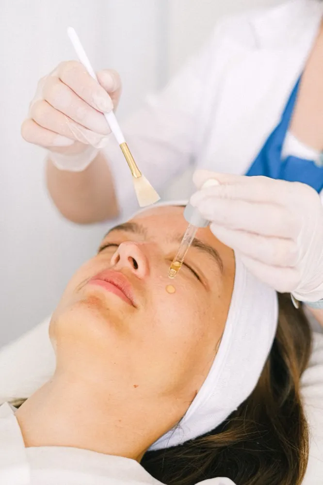 Peeling Químico: Qué Es, Tipos y Qué Esperar del Procedimiento