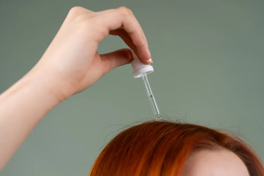 Tratamientos para la Caída del Cabello: PRP, Mesoterapia y Más