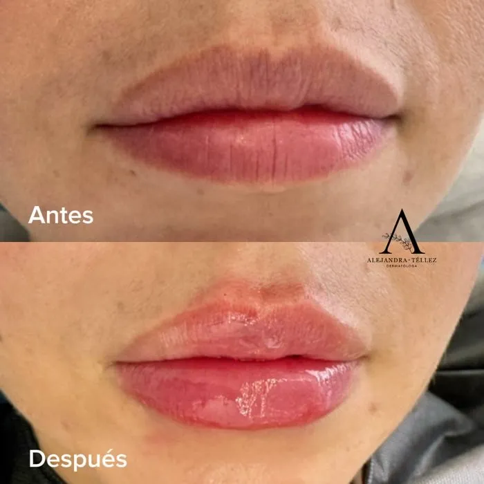 AH · Labios